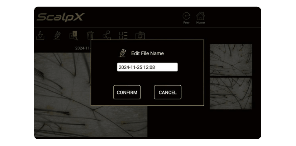 THIẾT BỊ KÍNH HIỂN VI KỸ THUẬT SỐ SOI DA ĐẦU 10