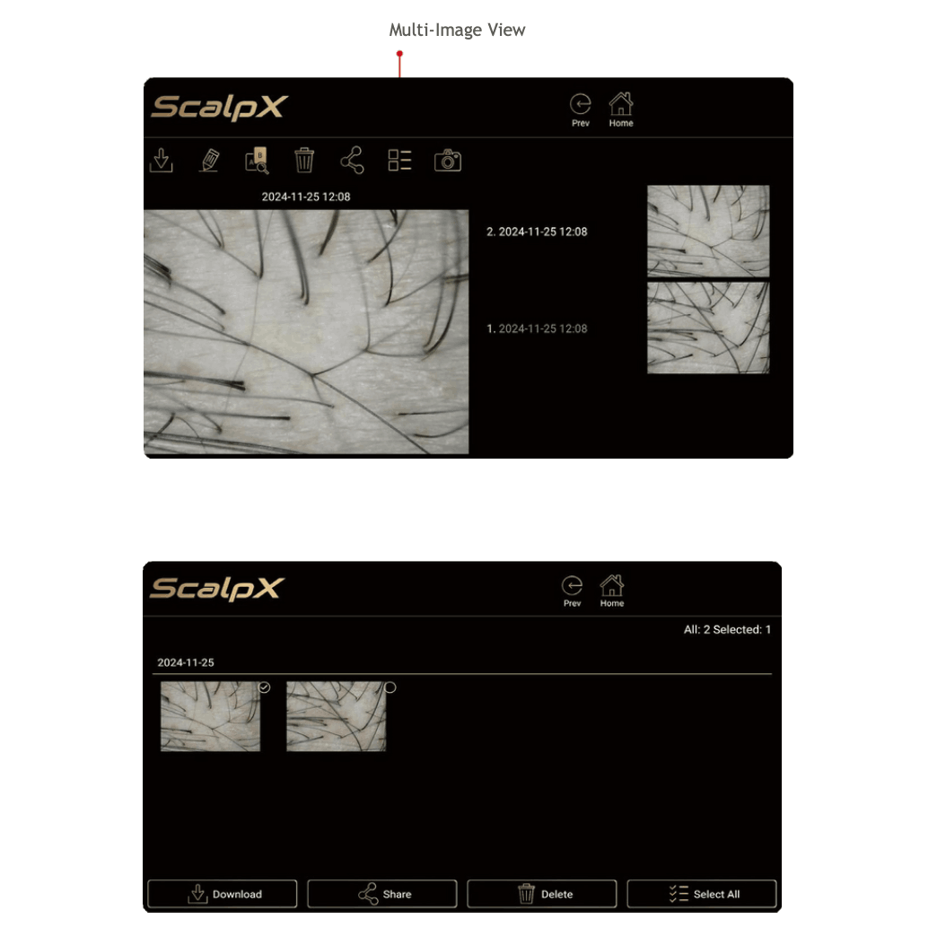 THIẾT BỊ KÍNH HIỂN VI KỸ THUẬT SỐ SOI DA ĐẦU 14