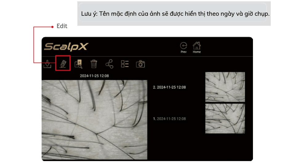 THIẾT BỊ KÍNH HIỂN VI KỸ THUẬT SỐ SOI DA ĐẦU 9