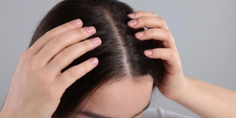 Glycyrrhetinic Acid – Nền tảng khoa học chăm sóc da đầu nhạy cảm2