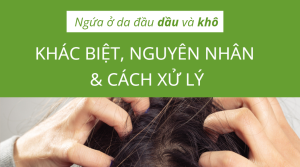 Ngứa ở da đầu dầu và khô: Sự khác biệt, nguyên nhân, dấu hiệu và cách xử lý 1